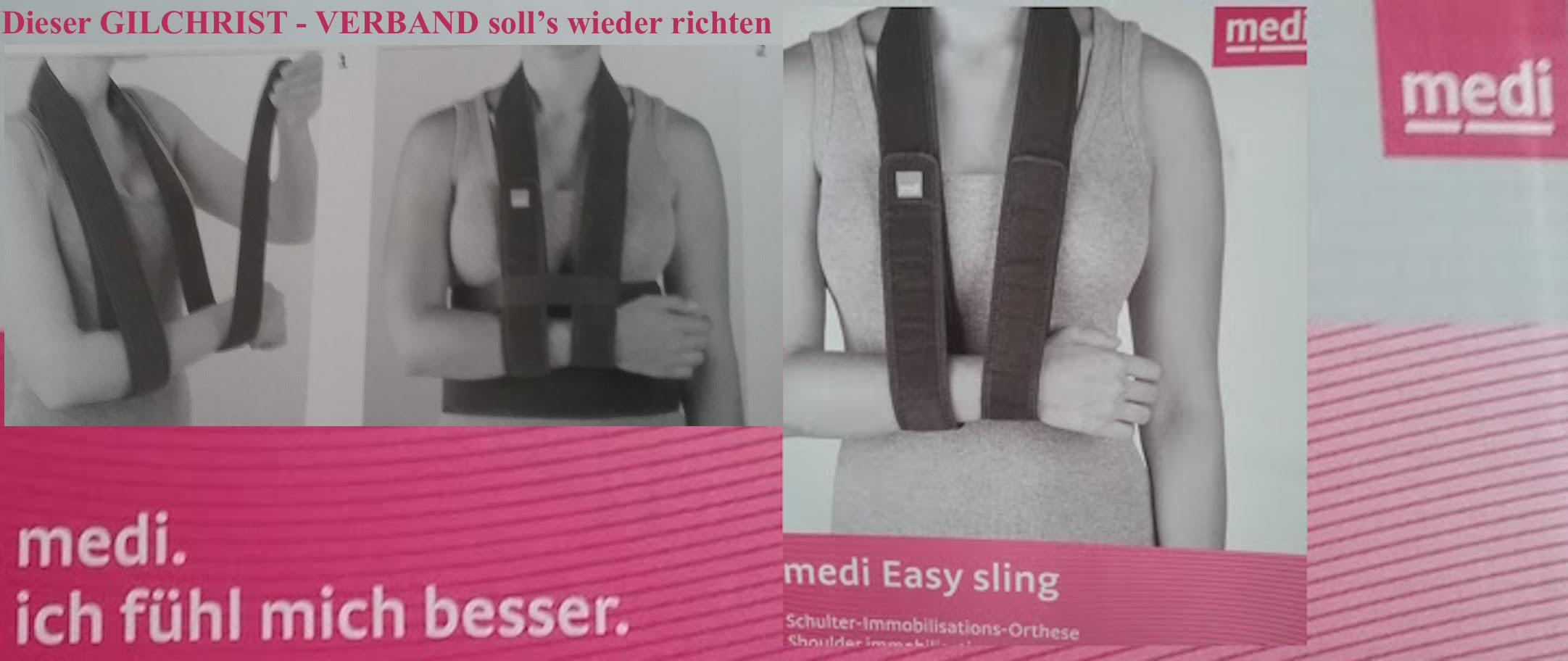 PachT u. Orthese nach STURZ 2018.03.05